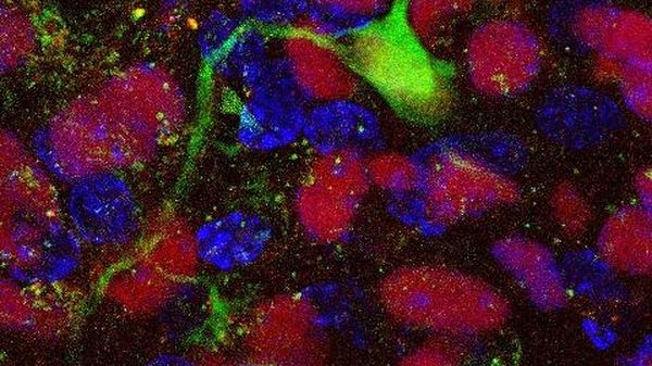 Immagine per None