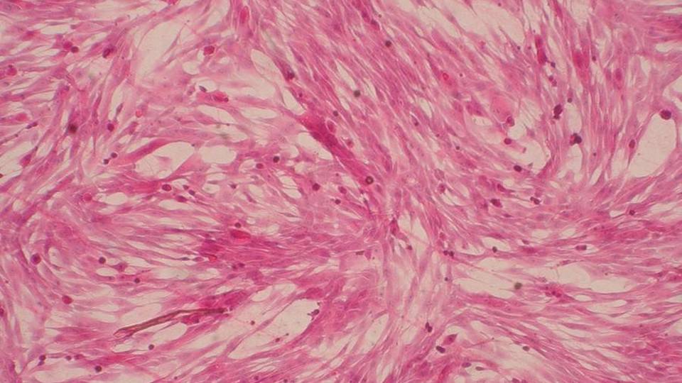 Riparare i tessuti bronchiali con le cellule staminali: lo IEO fa scuola Riparare i tessuti bronchiali con le cellule staminali: lo IEO fa scuola