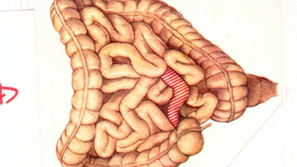 Un piccolo test può salvare la vita Un piccolo test può salvare la vita