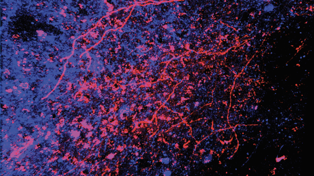 Scoperto il percorso delle carezze, dalla pelle al cervello Scoperto il percorso delle carezze, dalla pelle al cervello
