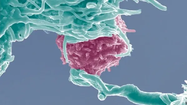 Immagine per 1364850e-0ac8-11ee-9217-7e561a13ede0