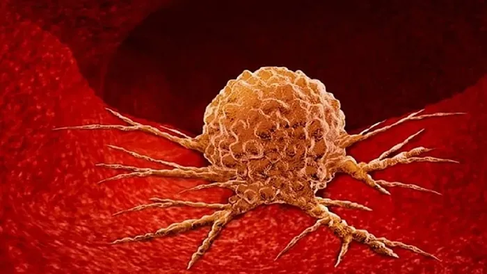 Breast Cancer Treatment: Major Advancements in Studies Breast Cancer Treatment: Major Advancements in Studies