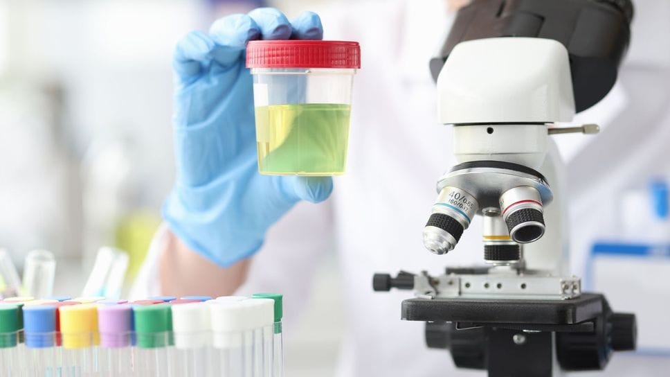 La presenza di sangue nelle urine deve essere sempre indagata La presenza di sangue nelle urine deve essere sempre indagata
