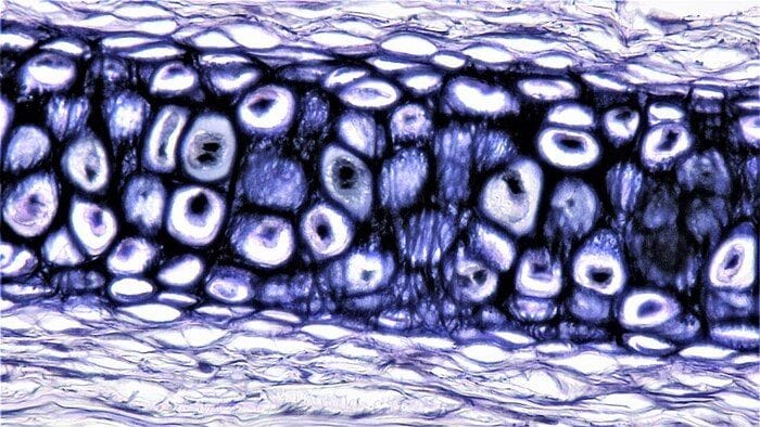 https://storage.ecodibergamo.it/media/photologue/2025/10/16/photos/cache/biomateriali-smart-e-staminali-rigenerano-le-articolazioni_444f9d98-aa71-11f0-b62b-466cf00c3c2b_v3_large_16_9.jpg