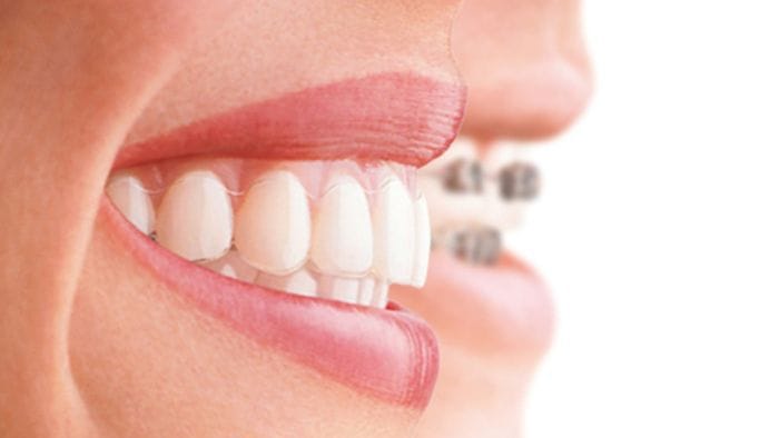 prevenzione dentale il 9 e 23 ottobre visite gratuite in humanitas