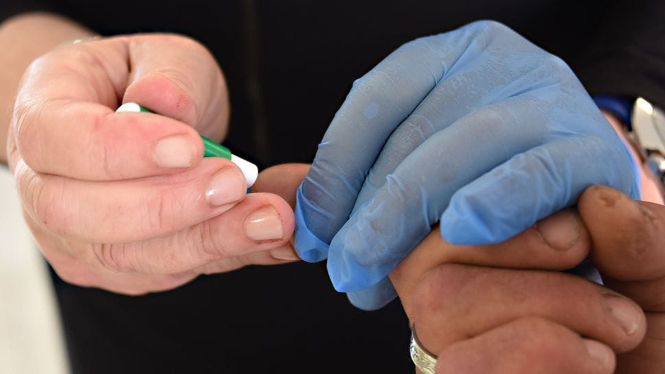 Lunedì 1°dicembre si celebra la GIornata mondiale dell’Aids. La sfida alla malattia passa attraverso la diagnosi precoce