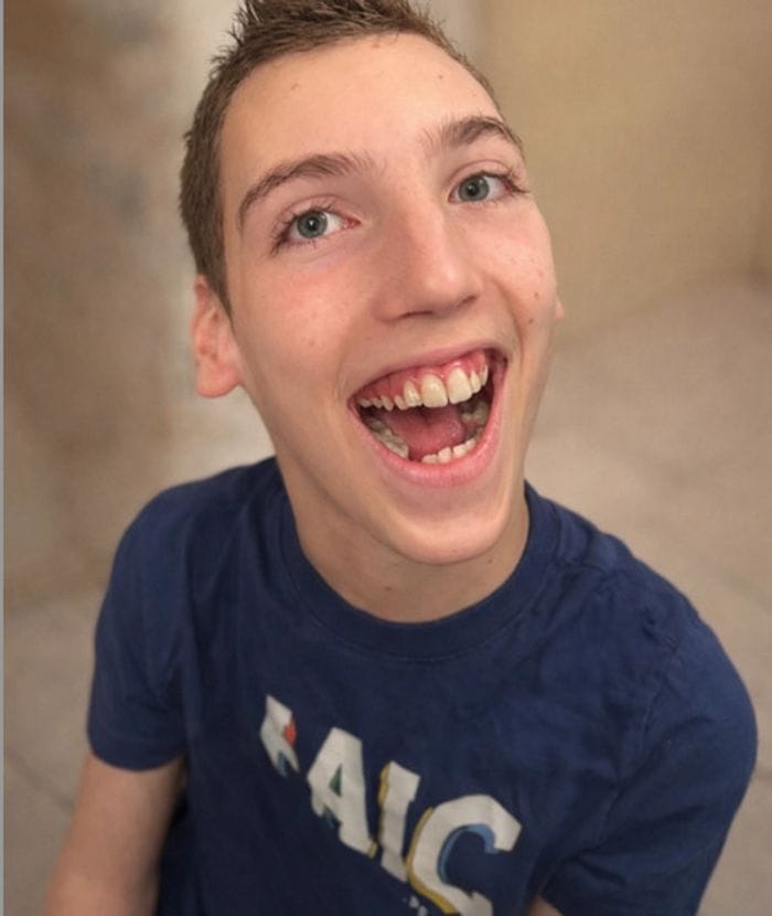 Diego Azzola, 15 anni