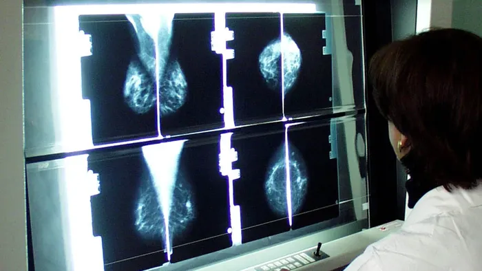 tumore al seno 330 visite gratis per educare alla prevenzione