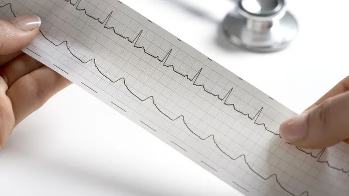 Giornata mondiale del cuore: screening per la prevenzione