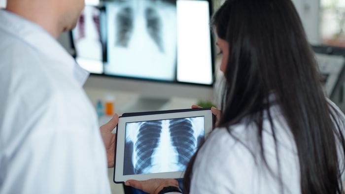 Tecniche mininvasive robotiche contro i tumori polmonari