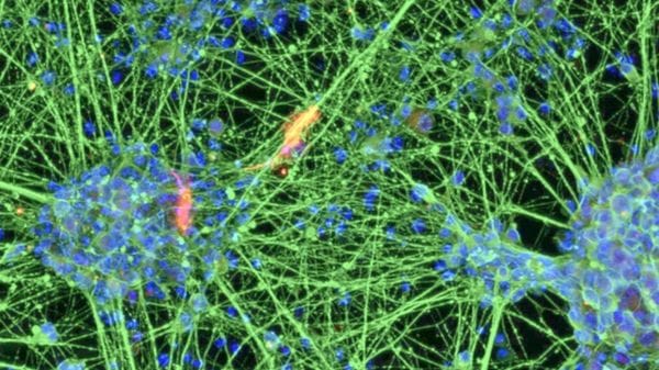 Vecchie cellule del sangue trasformate in giovani neuroni 