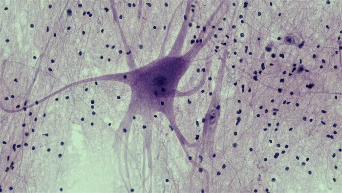 Trovata una molecola che protegge la memoria nell'invecchiamento  