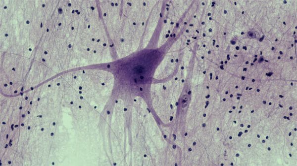 Trovata una molecola che protegge la memoria nell'invecchiamento  