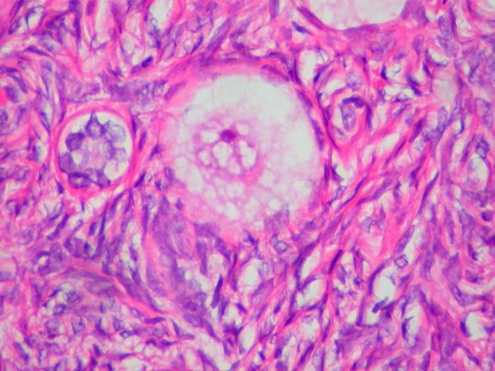 L'ovaio non va in pensione, dopo la menopausa continua a cambiare  