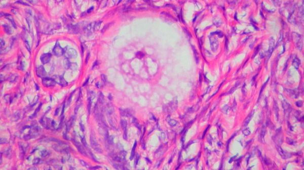 L'ovaio non va in pensione dopo la menopausa, continua a cambiare  