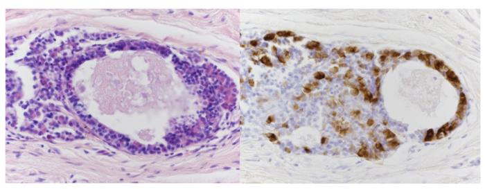 Riuscito in una scimmia il primo trapianto di ipofisi umana 
