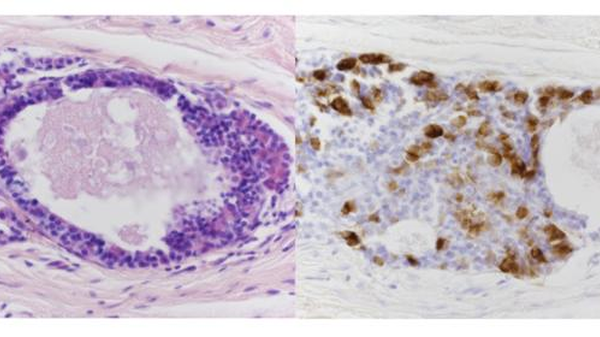 Riuscito in una scimmia il primo trapianto di ipofisi umana 