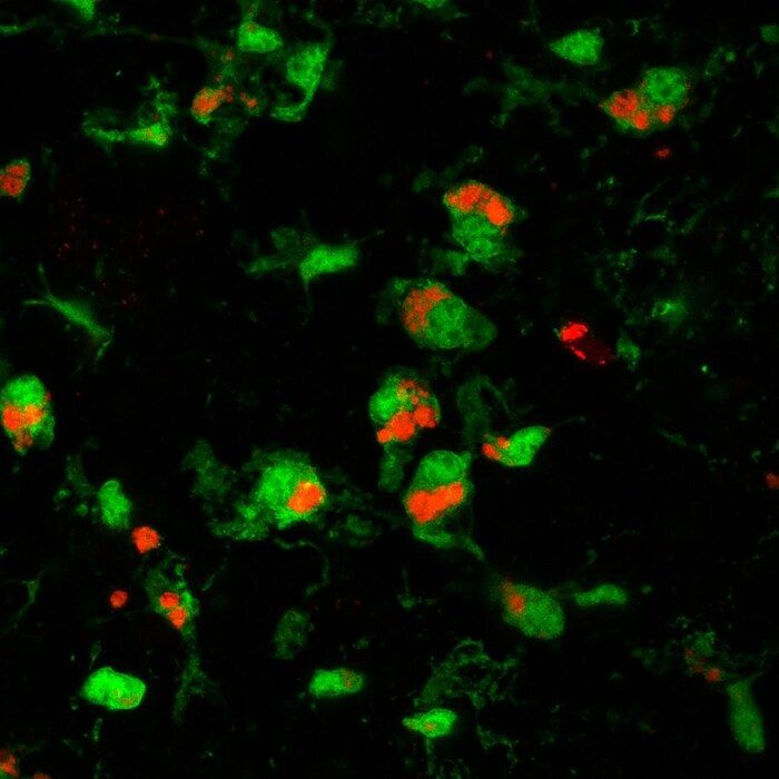 Cellule immunitarie proteggono il cervello dal Parkinson  