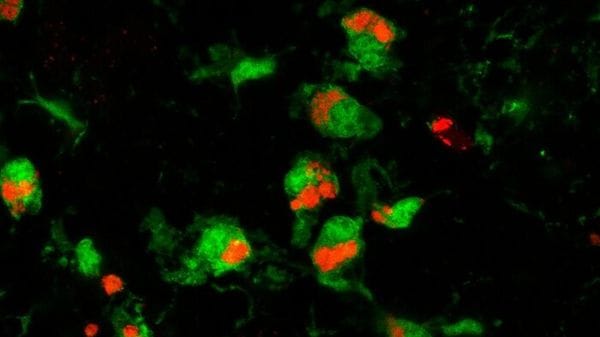 Cellule immunitarie proteggono il cervello dal Parkinson  