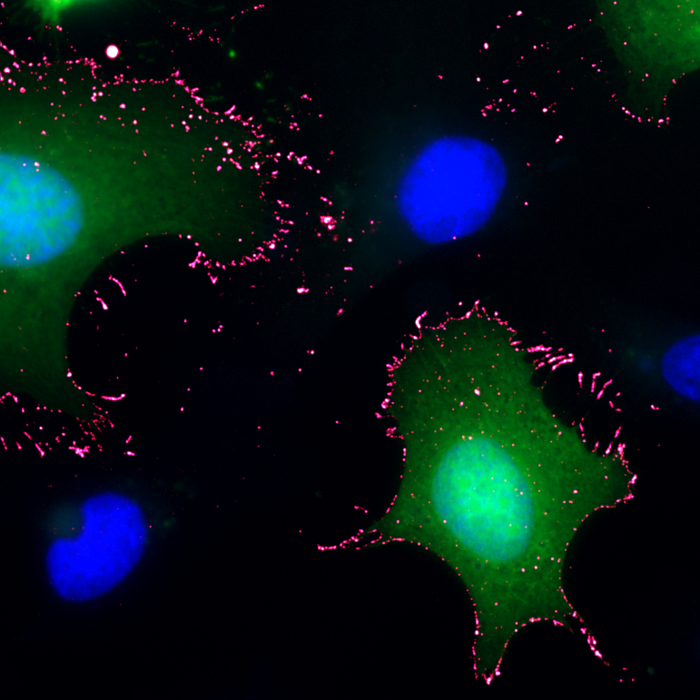 Così il virus Andes aggredisce e cellule umane