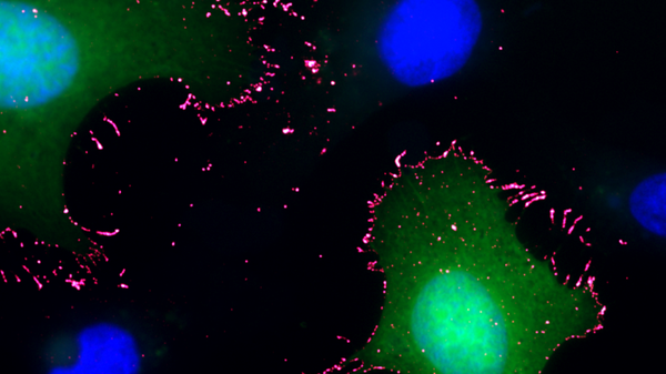 Così il virus Andes aggredisce e cellule umane