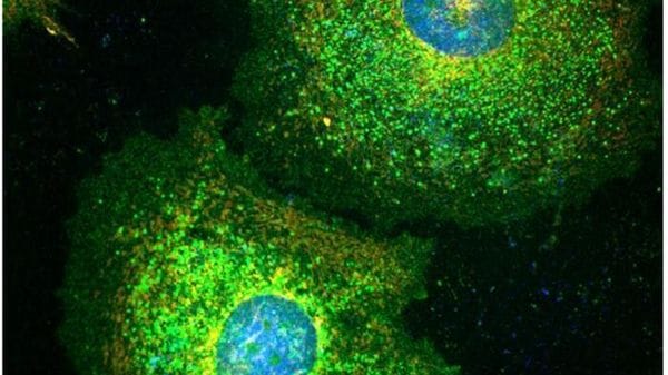 Le cellule tumorali diventano zombie per sfuggire alla chemioterapia 