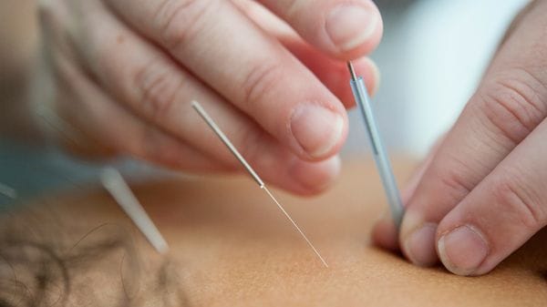 Difficile smettere di fumare ma l’agopuntura può aiutare