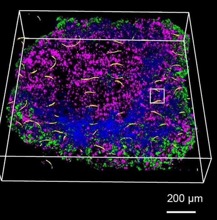 Modelli cyborg del pancreas controllano le fabbriche di insulina