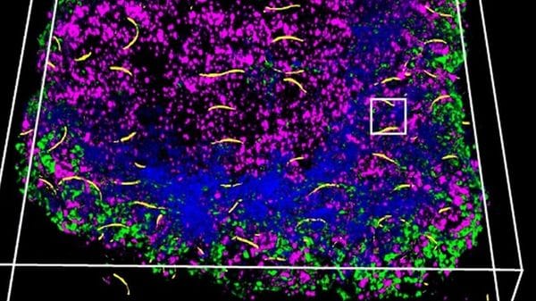 Modelli cyborg del pancreas controllano le fabbriche di insulina