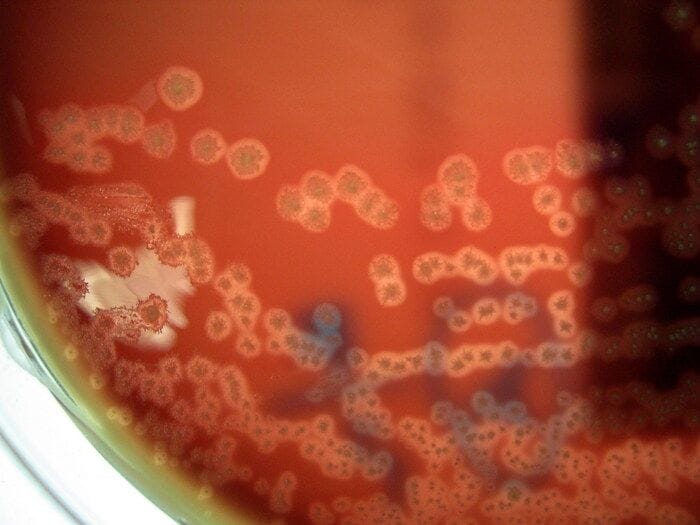 I primi batteri programmati per divorare i tumori dall'interno