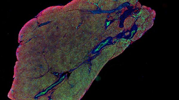 Individuato il meccanismo che attiva il tessuto bruciagrassi 