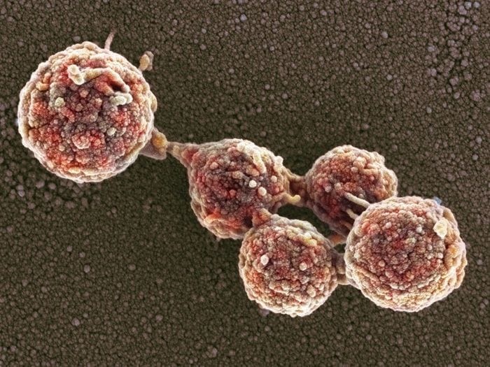 Ottenuto il primo batterio zombie, vive con il Dna di un'altra specie  