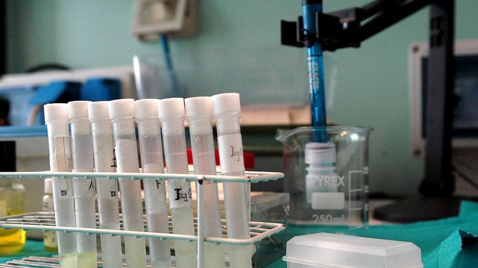 Ai partecipanti alla giornata è consigliato, se disponibile, portare con sé eventuali esami già effettuati, tra cui creatininemia; azotemia