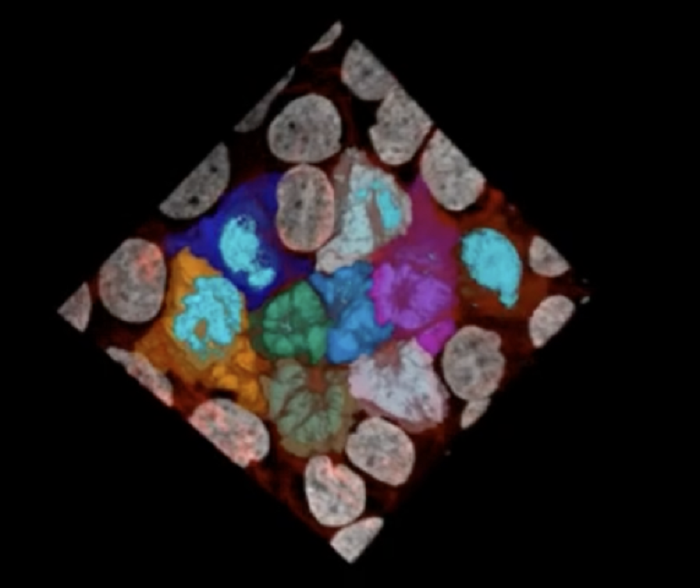 Tumori, viste le molecole che li rendono trasformisti e aggressivi 