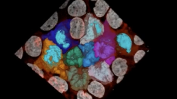 Tumori, viste le molecole che li rendono trasformisti e aggressivi 