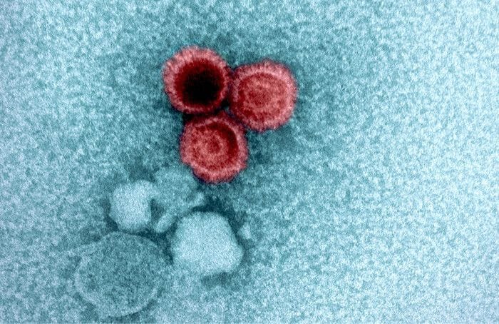 Anche il Dna umano determina se i virus restano nel corpo per anni