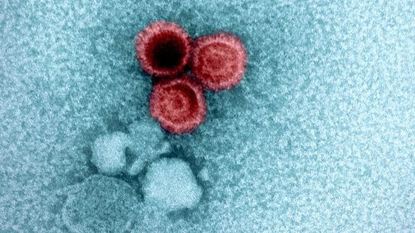 Anche il Dna umano determina se i virus restano nel corpo per anni