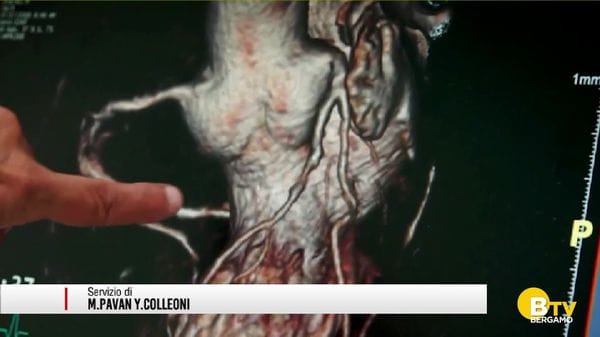 Trombosi e tumore, tra prevenzione e ricerca