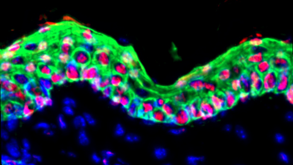 Trovata la chiave della memoria a lungo termine della pelle