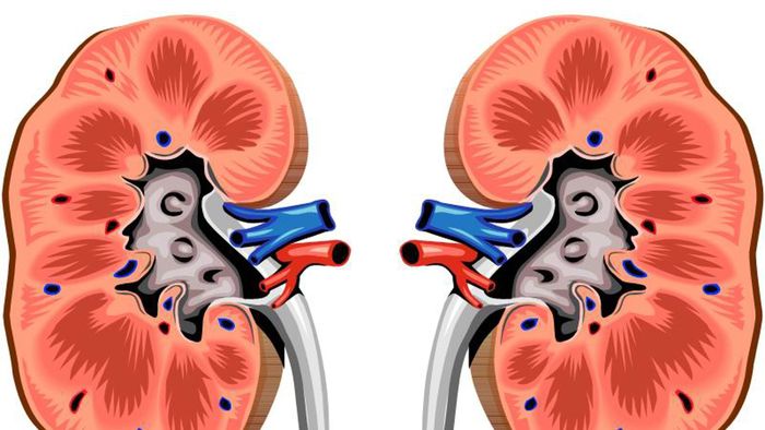 calcoli renali le cause i sintomi e i trattamenti innovativi
