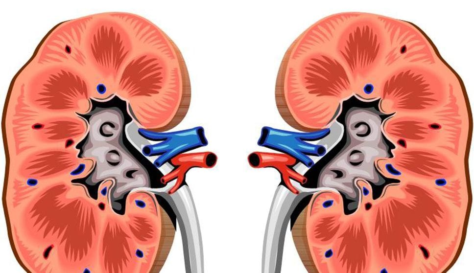 Calcoli renali: le cause, i sintomi e i trattamenti innovativi