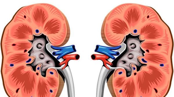 Calcoli renali: le cause, i sintomi e i trattamenti innovativi