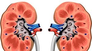 Calcoli renali: le cause, i sintomi e i trattamenti innovativi