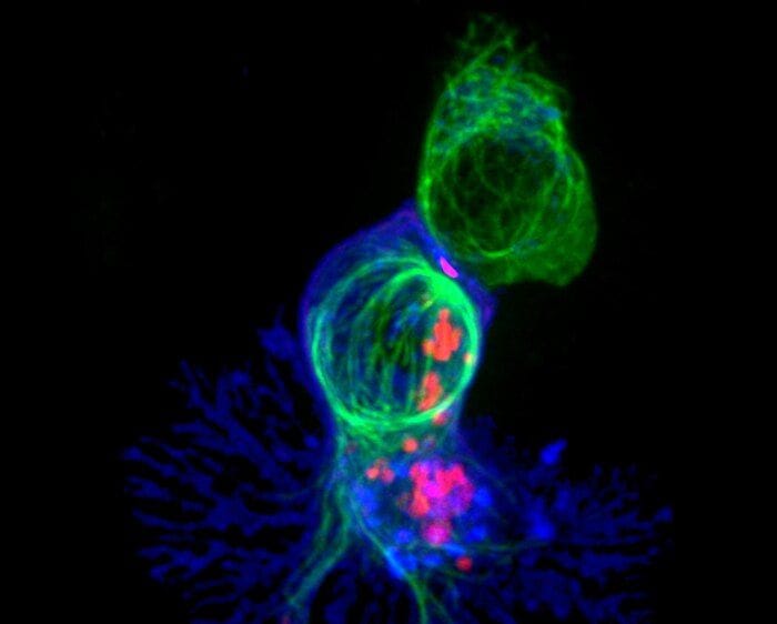 Trovata una strategia per strappare ai tumori il mantello dell’invisibilità  
