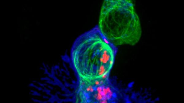 Una molecola strappa ai tumori il mantello dell'invisibilità 