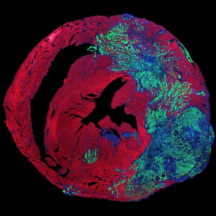 Il battito del cuore apre una nuova strada per combattere i tumori