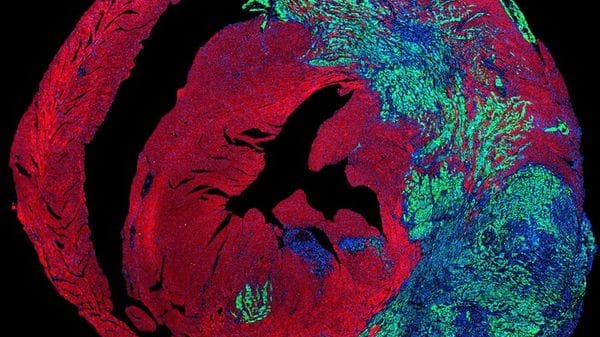 Il battito del cuore apre una nuova strada per combattere i tumori