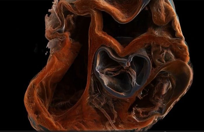 Nel 2027 la prima scansione 3D del corpo umano  VIDEO