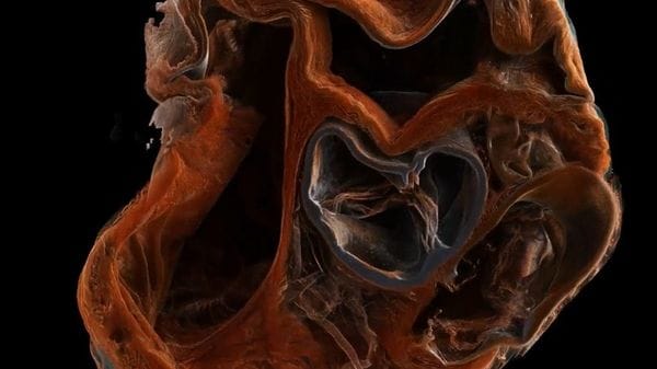 Nel 2027 la prima scansione 3D del corpo umano  VIDEO