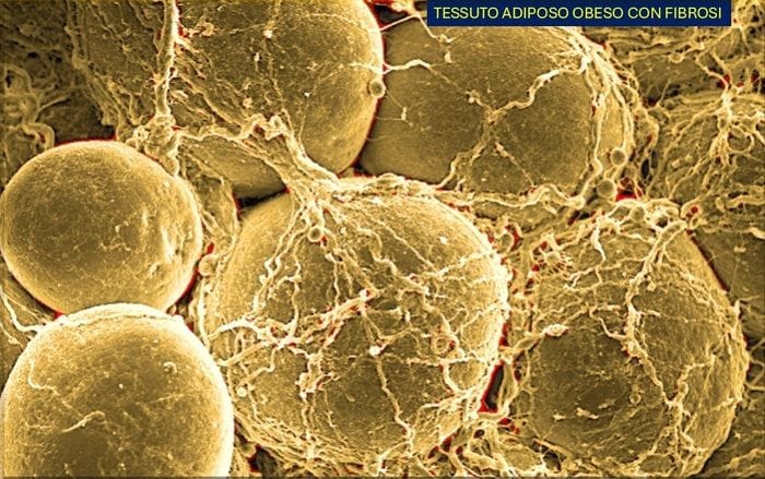 Obesità, tre cause spingono il meccanismo che la rende più grave 